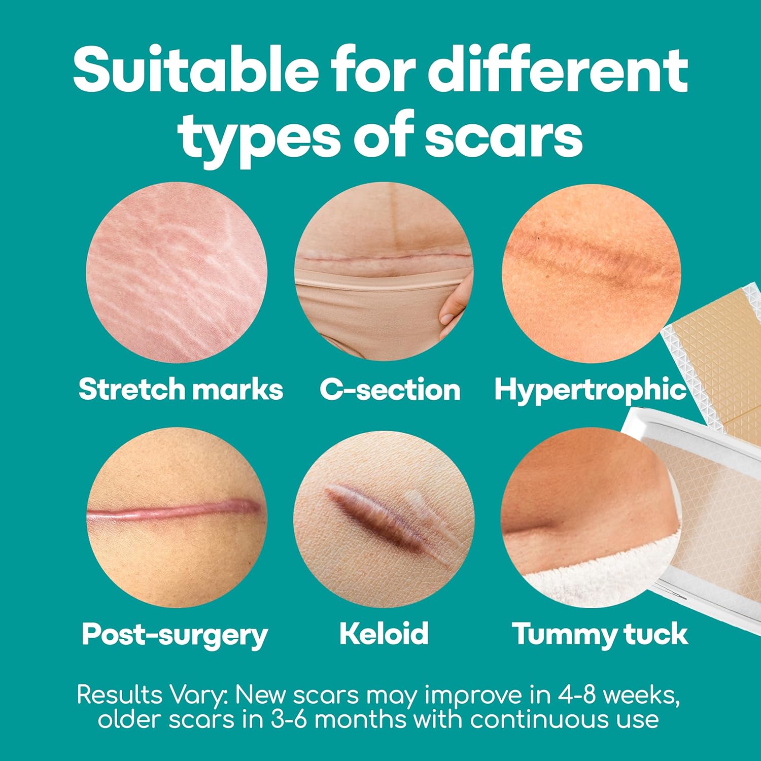 Medi Grade Silicone Scar Sheets, 80 Inches Long, Reusable with Storage Case C2293