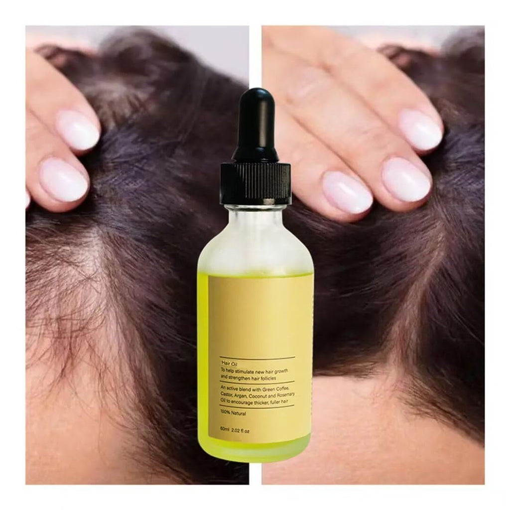 Rosemary & Parsley Seed Hair Growth Oil, Extra Strength Treatment for Hair Loss, 2 Oz Y2778