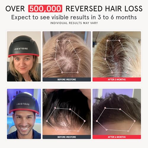 iRESTORE Elite Laser Hair Growth System - FDA Cleared Red Light Therapy Cap for Hair Regrowth M5959