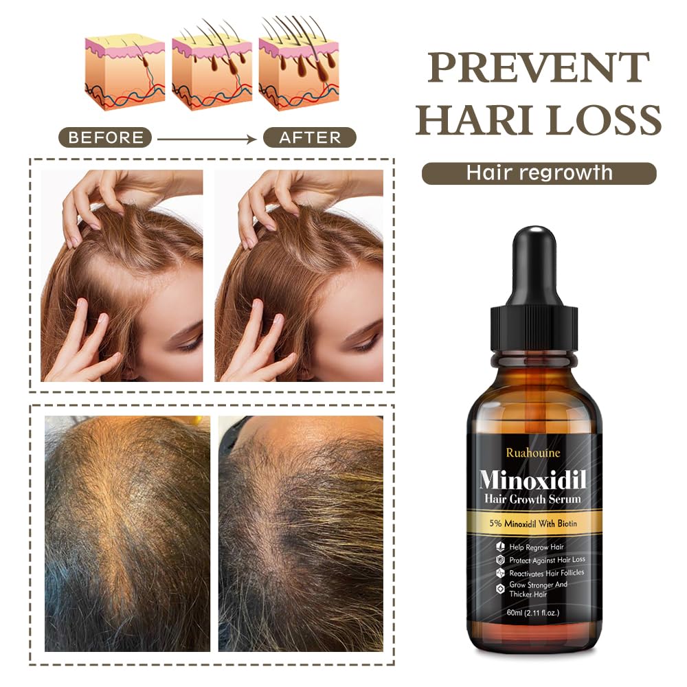 Hair Growth Serum Oil with 5% Minoxidil for Men and Women, 2.11oz C848756