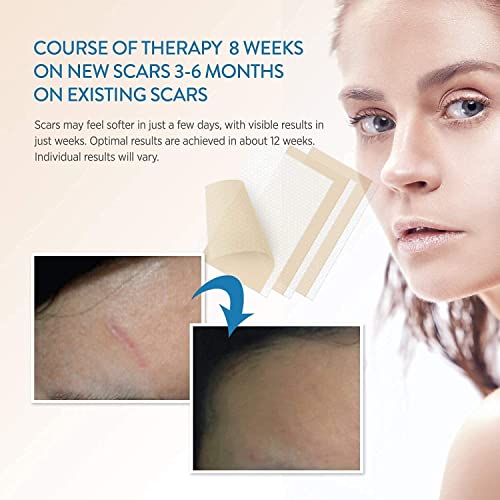 Aroamas Professional Soft Silicone Scar Sheets Strips, 8 Count F291013
