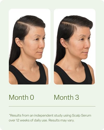 Divi Hair Scalp Serum for Women and Men, 100ml O122