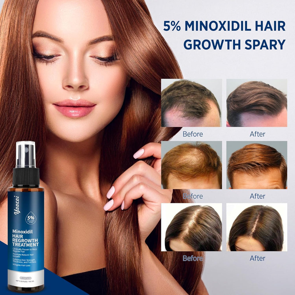 Minoxidil 5% Hair Growth Serum for Men and Women with Biotin 100ml X1427
