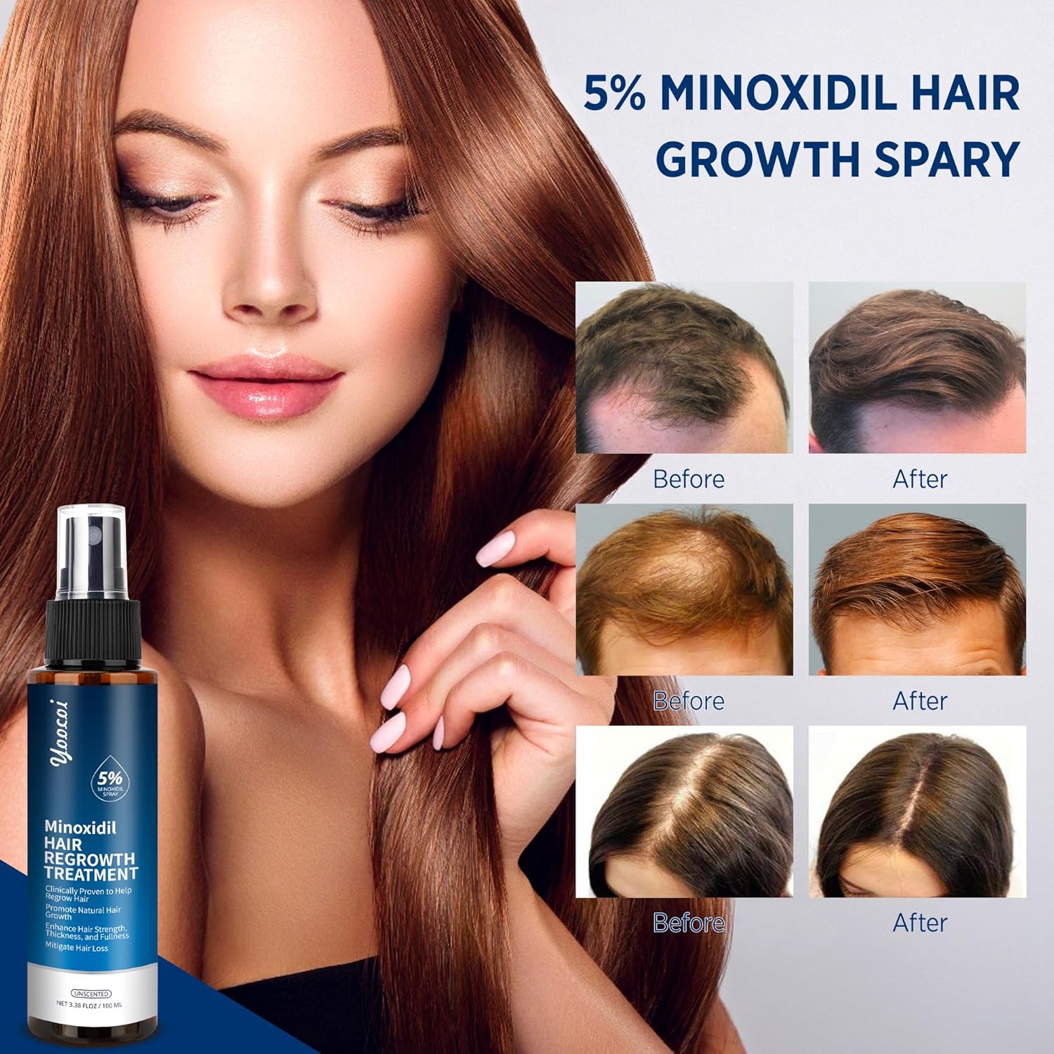Minoxidil 5% Hair Growth Serum for Men and Women with Biotin 100ml X1427