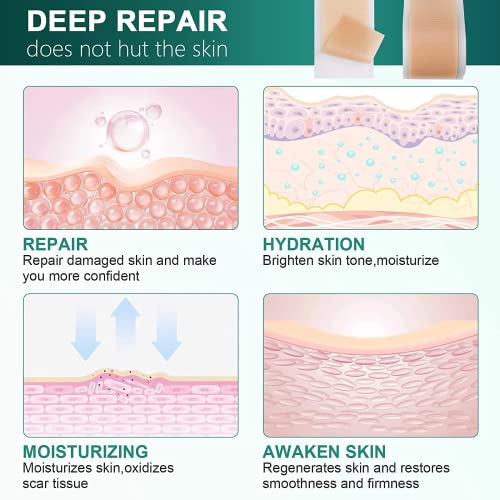 Silicone Scar Sheets for Surgical Scars, Keloid, C-Section, Tummy Tuck H3296