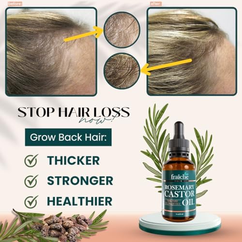 Rosemary & Castor Oil Hair Growth Treatment, 2oz by Live Fraiche Q16436