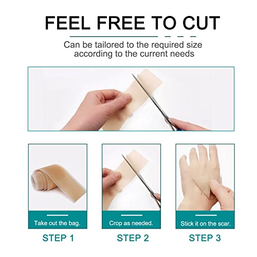 Silicone Scar Sheets Roll for C-Section, Surgery, Burn, Keloid, Acne P55830