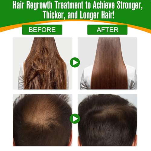 Rosemary Oil for Hair Growth Organic - Pure for Eyebrow and Eyelash with Biotin P409934