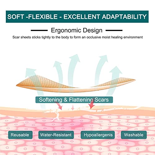 Silicone Scar Sheets Roll for C-Section, Surgery, Burn, Keloid, Acne P55830