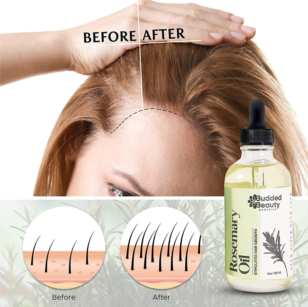 Rosemary Oil for Hair Growth with Dropper D64132