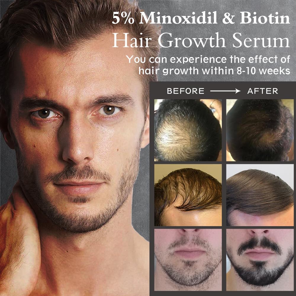 Hair Growth Serum Oil with 5% Minoxidil for Men and Women, 2.11oz C848756